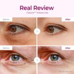Dr.Melaxin Calcium Volume Under Eye Patches for Puffy Eyes & Dark Circles - Image 4